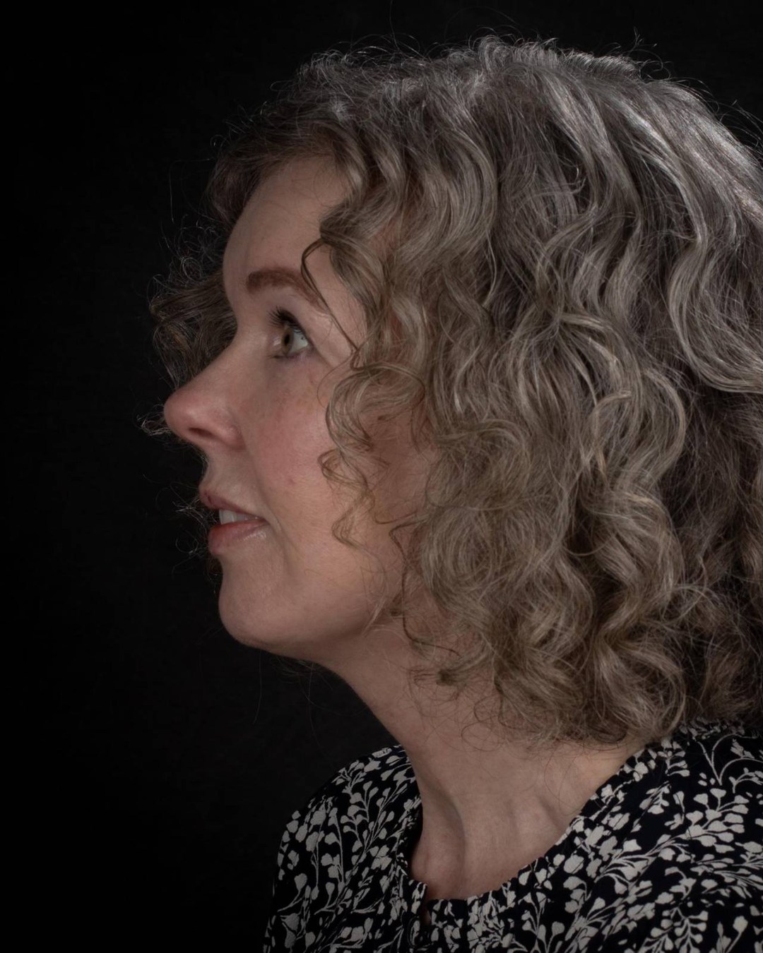 After face and neck lift, profile