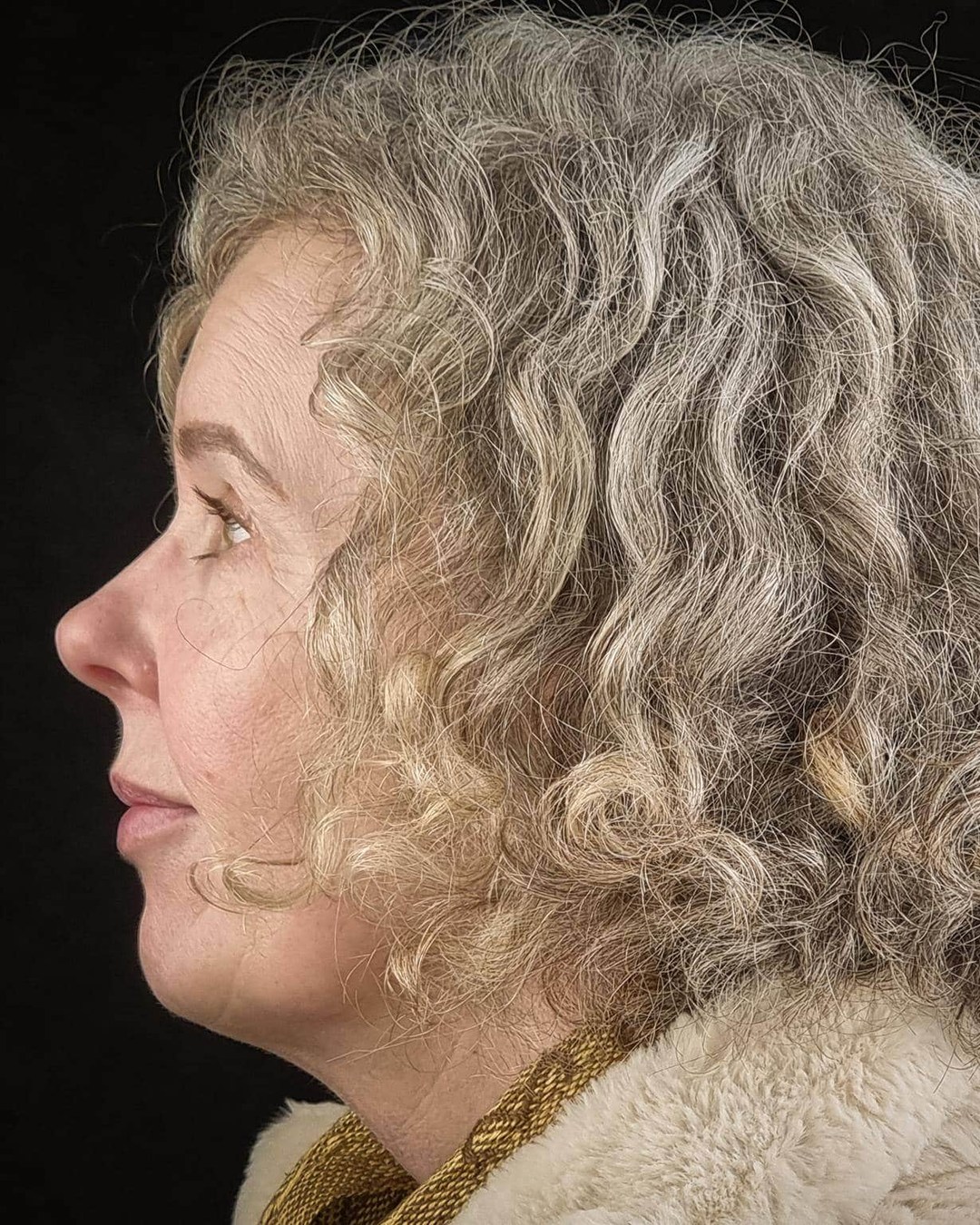 Before face and neck lift, profile